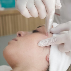 Dermassy Concentre Blend Aclarante x 5 Ampollas